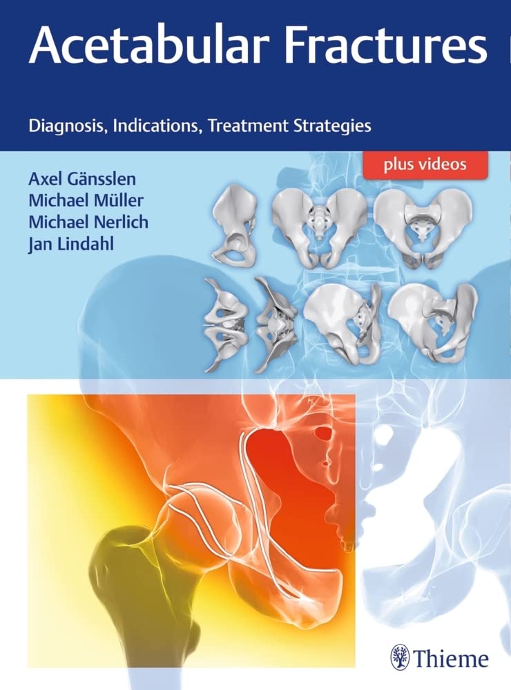 Buy Acetabular Fractures: Diagnosis, Indications, Treatment Strategies (English, Paperback, Axel Gänsslen, Michael Müller, Michael Nerlich, Jan Lindahl) Online at Best Price - GlowMirror