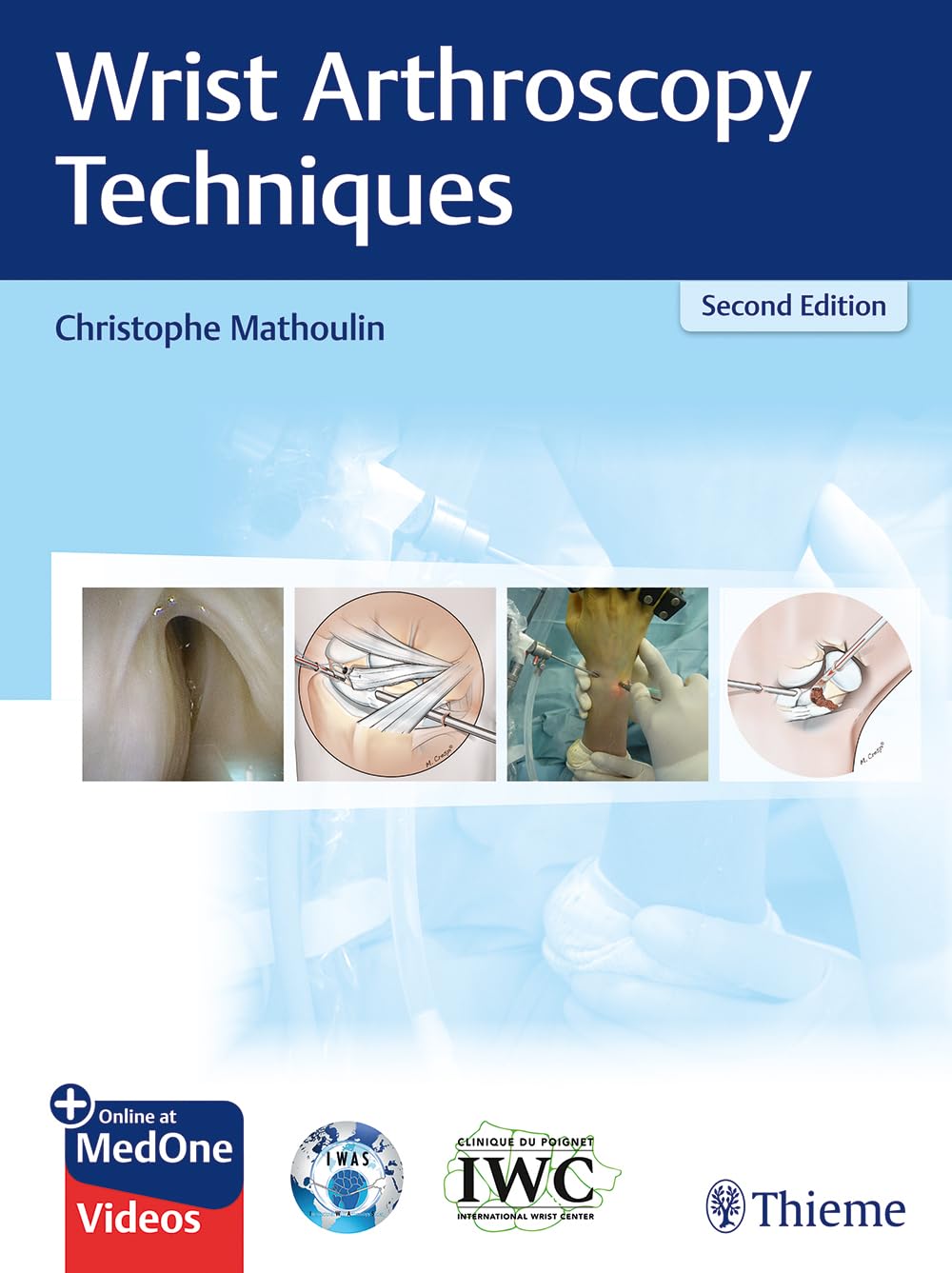 Buy Wrist Arthroscopy Techniques (English, Paperback, Christophe Mathoulin) Online at Best Price - GlowMirror