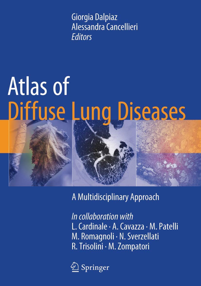 Buy Atlas of Diffuse Lung Diseases: A Multidisciplinary Approach (English, Paperback, Giorgia Dalpiaz, Alessandra Cancellieri) Online at Best Price - GlowMirror
