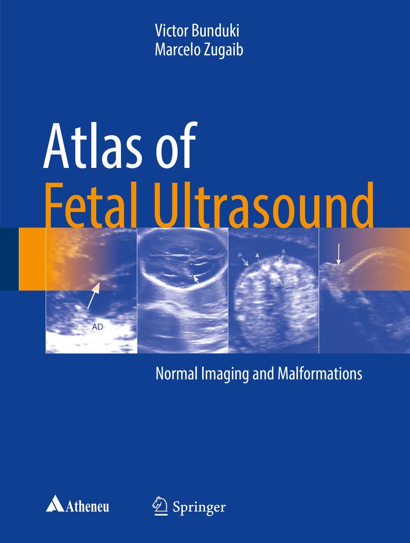 Buy Atlas of Fetal Ultrasound: Normal Imaging and Malformations (English, Paperback, Victor Bunduki, Marcelo Zugaib) Online at Best Price - GlowMirror