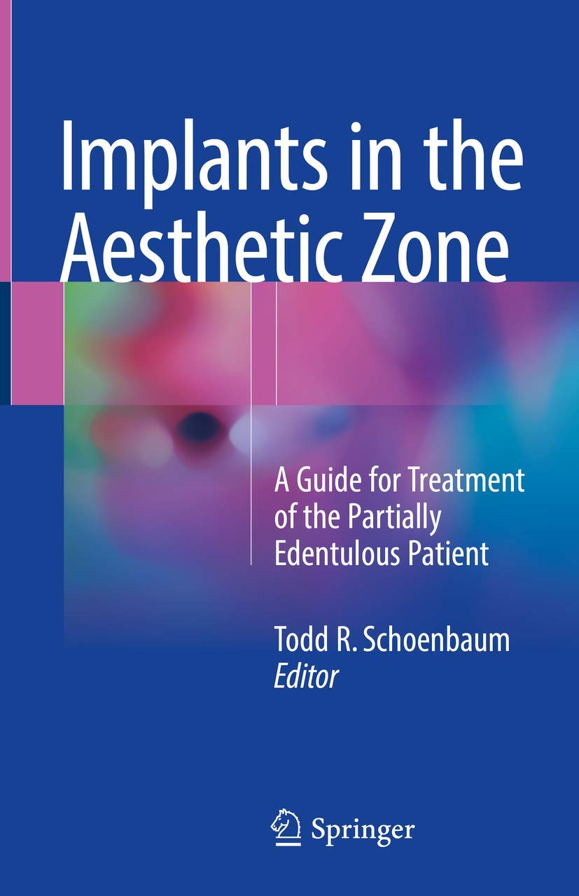 Buy Implants in the Aesthetic Zone: A Guide for Treatment of the Partially Edentulous Patient (English, Paperback, Todd R. Schoenbaum) Online at Best Price - GlowMirror