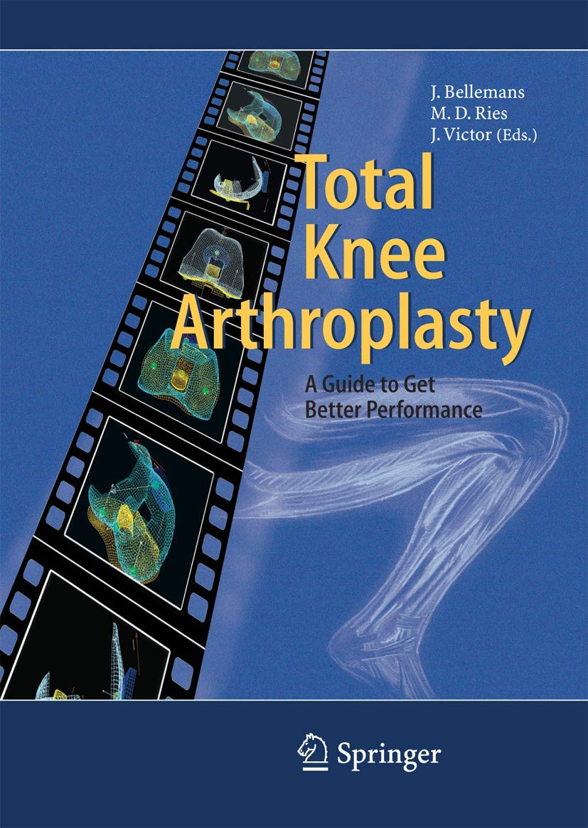 Buy Total Knee Arthroplasty: A Guide to Get Better Performance (English, Hardcover, Johan Bellemans, Michael D. Ries, Jan M.K. Victor) Online at Best Price - GlowMirror