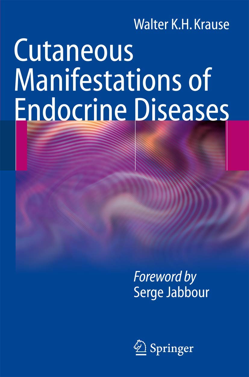 Buy Cutaneous Manifestations of Endocrine Diseases (English, Paperback, Walter K.H. Krause, Serge Jabbour, N. Stutz) Online at Best Price - GlowMirror