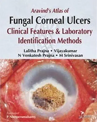 Buy Aravind'S Atlas OF Fungal Corneal Ulcers Clinical Features & LAB.Identification Methods (English, Hardcover, Prajna) Online at Best Price - GlowMirror