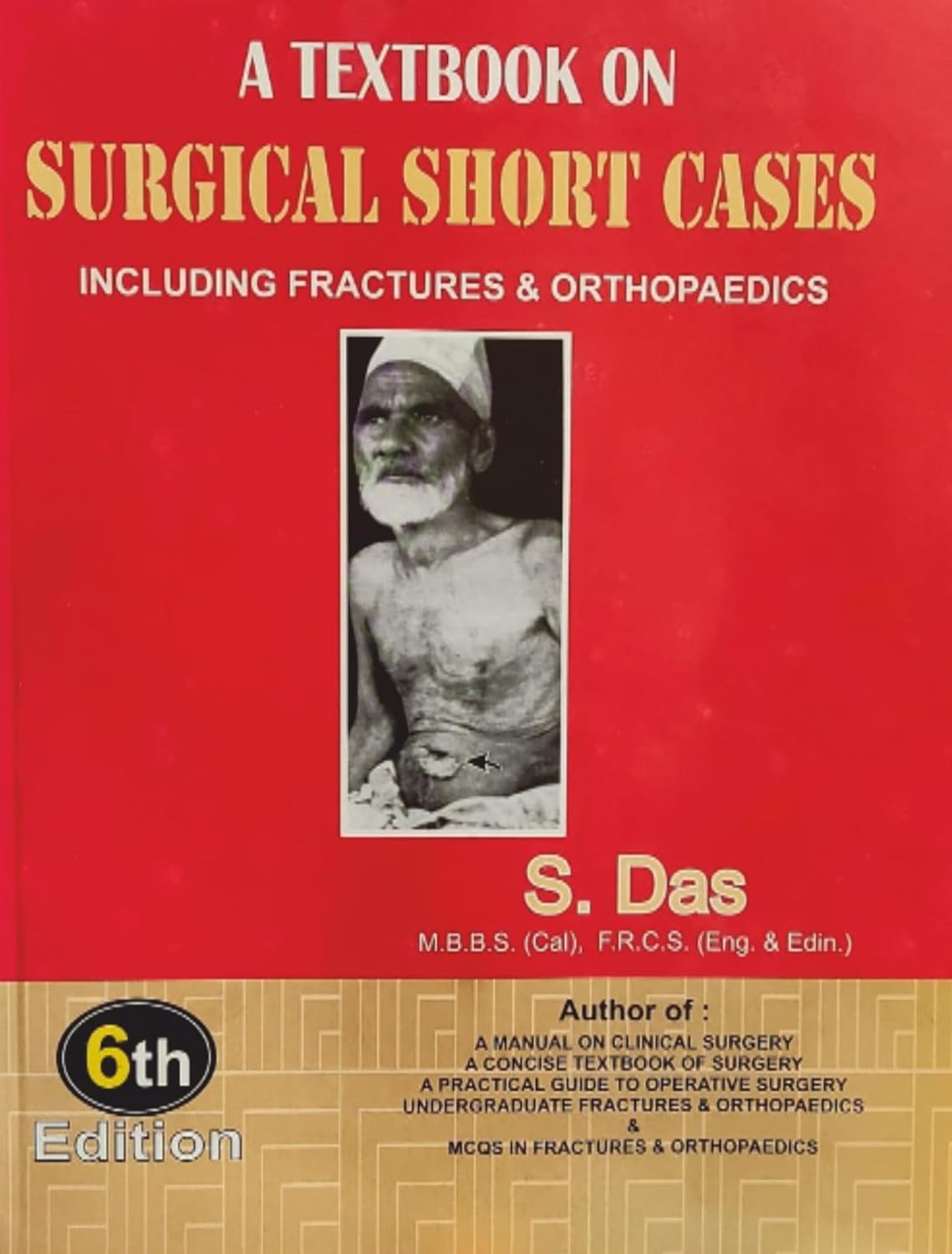 Buy A Textbook on Surgical Short Cases: Including Fractures & Orthopaedics (English, Paperback, S Das) Online at Best Price - GlowMirror