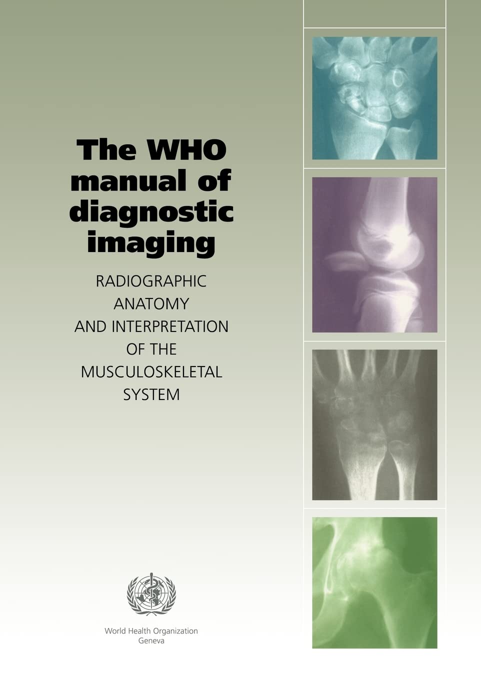 Buy Who Manual Of Diagnostic Imaging: Radiographic Anatomy And Interpretation Of The Muskuloskeletal (English, Paperback, A. M. Davies) Online at Best Price - GlowMirror