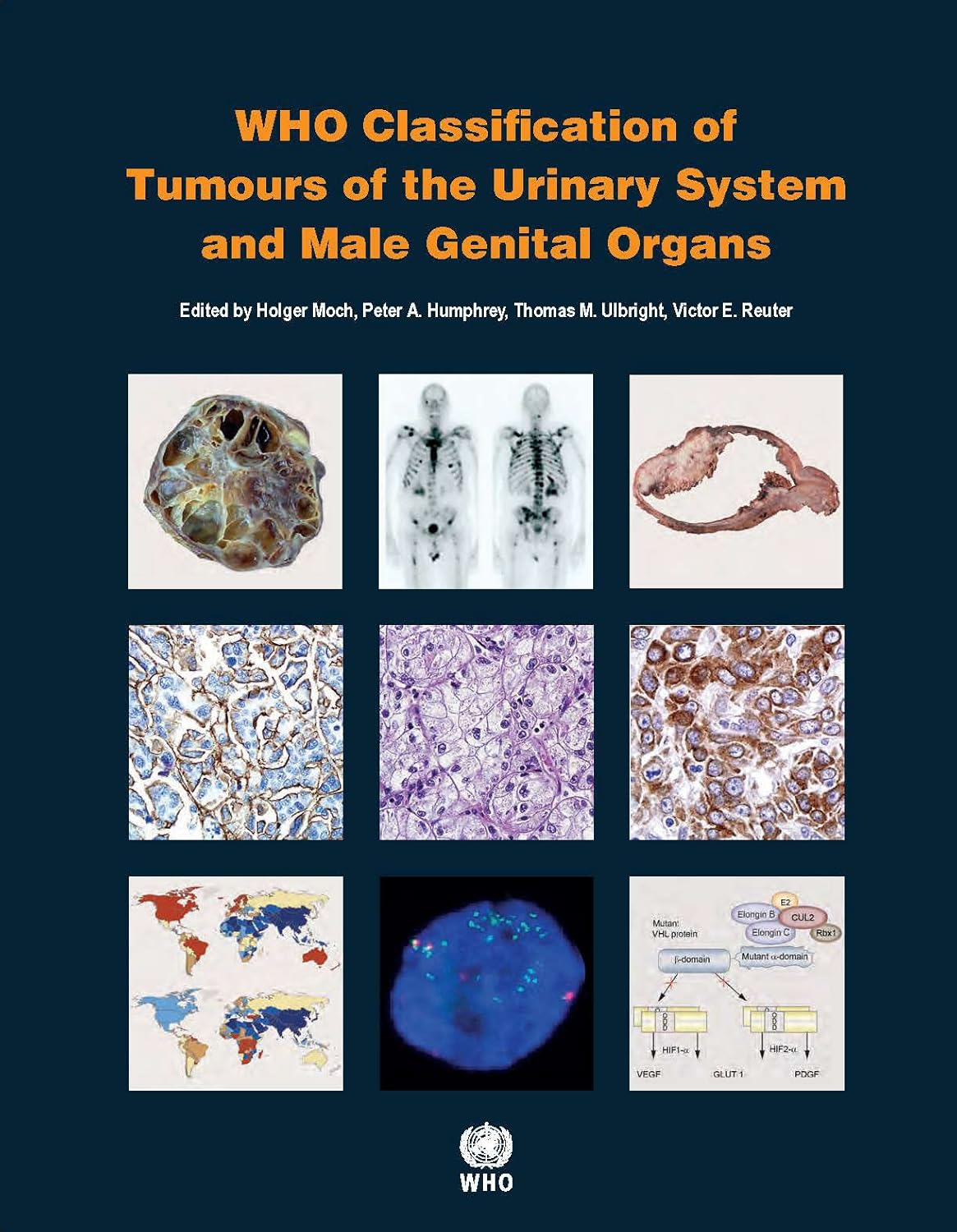 Buy WHO classification of tumours of the urinary system and male genital organs: 8 (World Health Organization Classification of Tumours) (English, Pape... Online at Best Price - GlowMirror