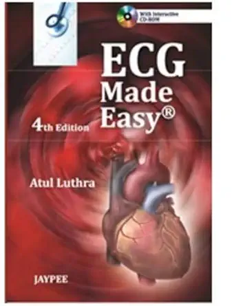 Buy Ecg Made Easy with Interactive CD-ROM (English, Paperback, Luthra) Online at Best Price - GlowMirror