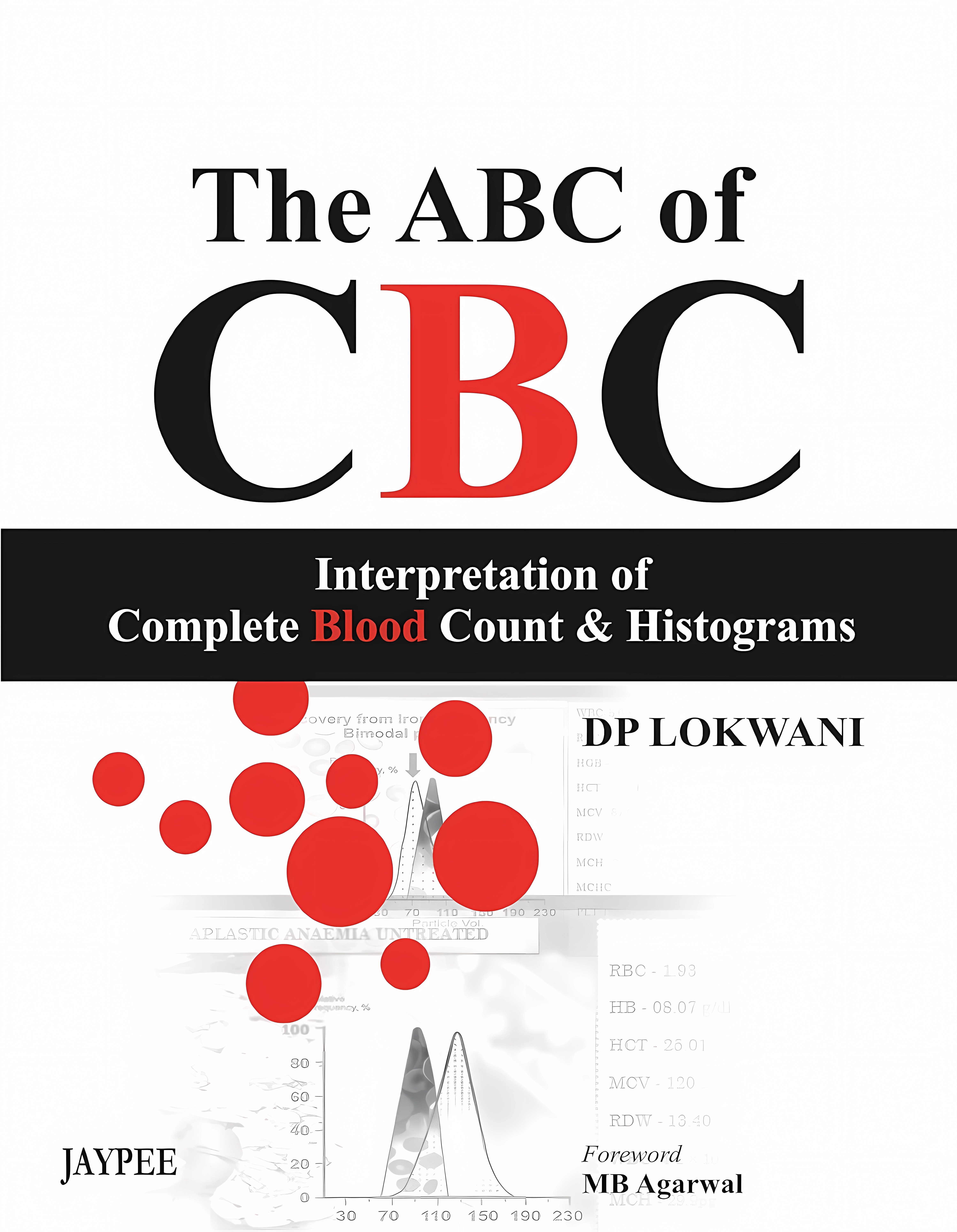 Buy The Abc Of Cbc Interpretation Of Complete Blood Count & Histograms (English, Paperback, Lokwani Dp) Online at Best Price - GlowMirror