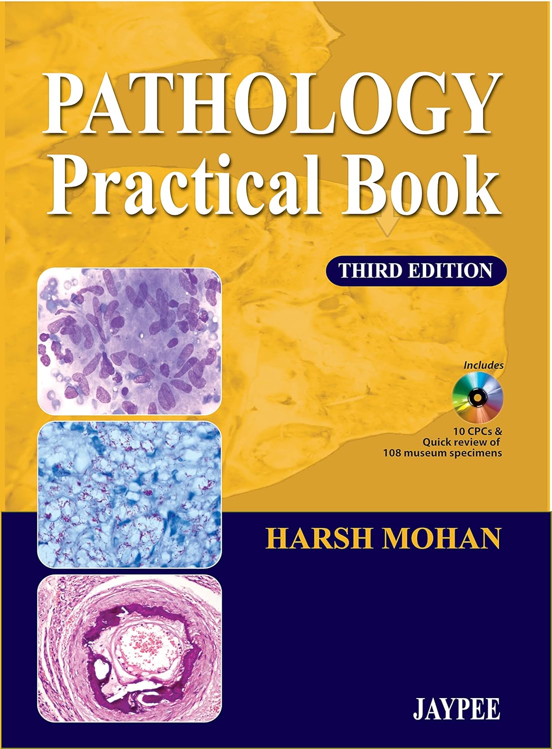 Buy (Old) Pathology Practical Book Includes 10Cpcs & Quick Review Of 108 Museum Specimens (English, Paperback, Harsh Mohan) Online at Best Price - GlowMirror