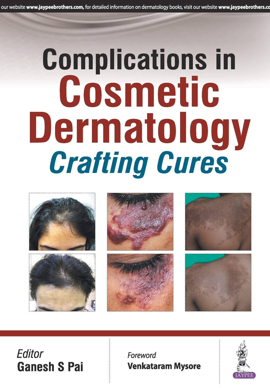 Buy Complications in Cosmetic Dermatology: Crafting Curves (English, Paperback, Pai Ganesh S) Online at Best Price - GlowMirror
