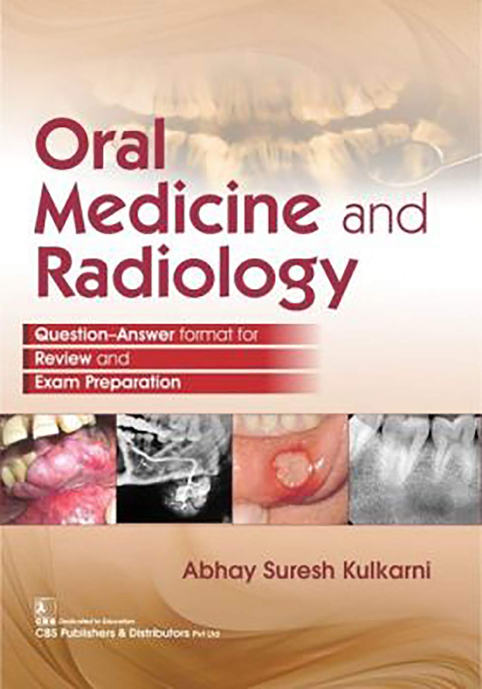 Buy Oral Medicine AND Radiology (PB 2019) (English, Paperback, Kulkarni A S) Online at Best Price - GlowMirror