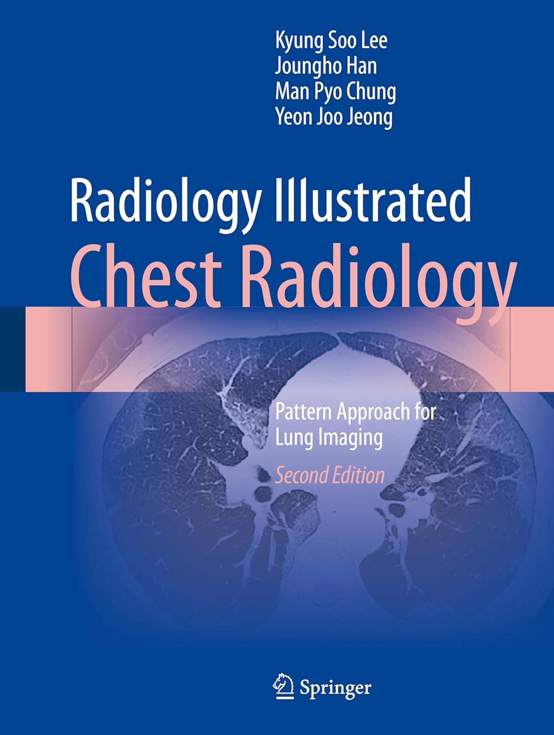 Buy Radiology Illustrated: Chest Radiology: Pattern Approach for Lung Imaging (English, Paperback, Kyung Soo Lee, Joungho Han, Man Pyo Chung, Yeon Joo ... Online at Best Price - GlowMirror