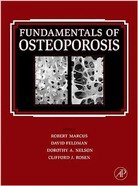 Fundamentals Of Osteoporosis (English, Robert Marcus)