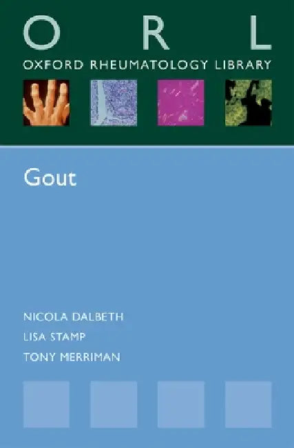 Gout (English, Nicola Dalbeth | Lisa Stamp | Tony Merriman)