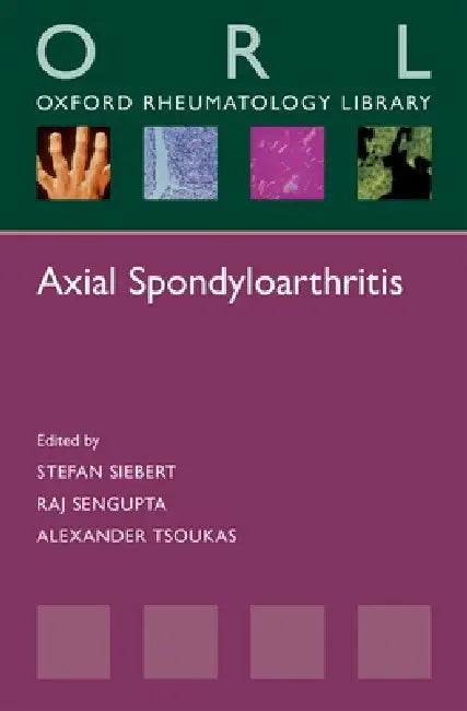 Axial Spondyloarthritis (English, Stefan Siebert | Raj Sengupta | Alexander Tsoukas)