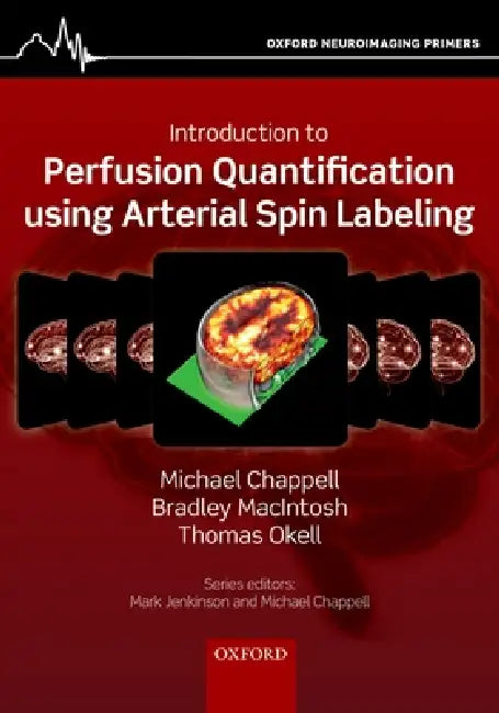 Introduction to Perfusion Quantification Using Arterial Spin Labelling (English, Michael Chappell | Bradley Macintosh | Thomas Okell)