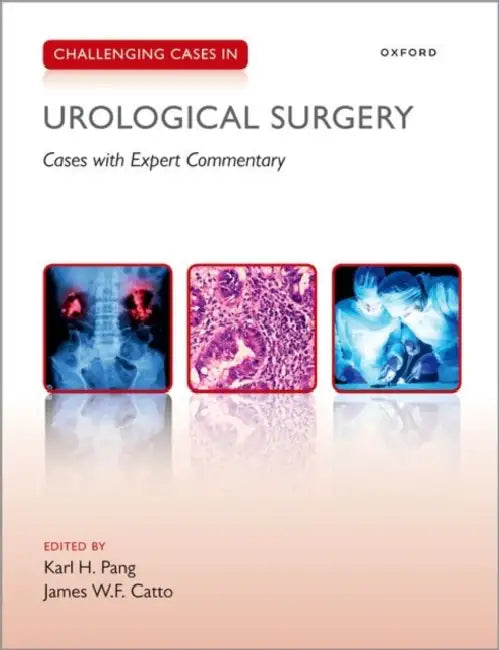 Challenging Cases In Urological Surgery (English, Karl Pang)