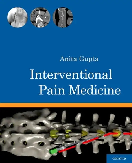 Interventional Pain Medicine (English, Anita Gupta)