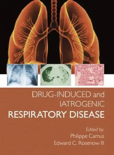 Drug-Induced and Iatrogenic Respiratory Disease (English, Camus Phillipe | Edward Rosenow III)