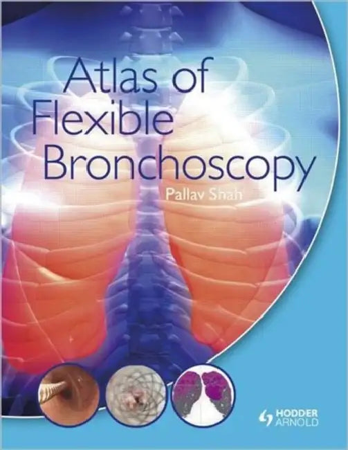 Atlas of Flexible Bronchoscopy (English, Shah Pallav)