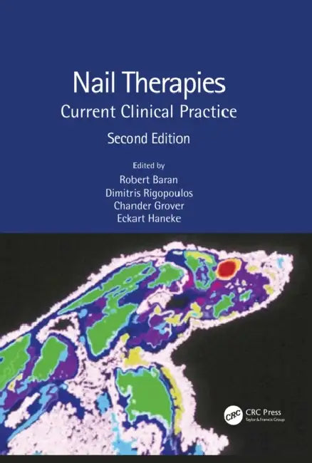 Nail Therapies (English, Baran Robert | Dimitris Rigopoulos | Chander Grover)