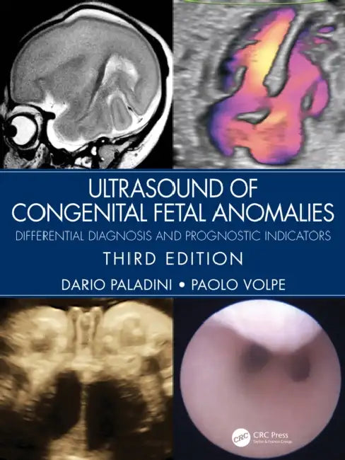 Ultrasound of Congenital Fetal Anomalies (English, Paladini Dario | Paolo Volpe)