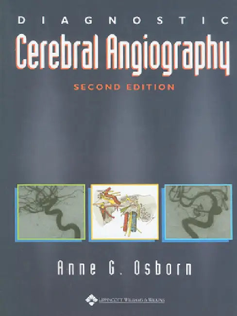 Diagnostic Cerebral Angiography (English, Anne G. Osborn)