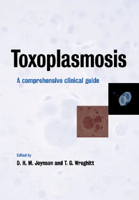 Toxoplasmosis (English, David H. M. Joynson | Tim G. Wreghitt)