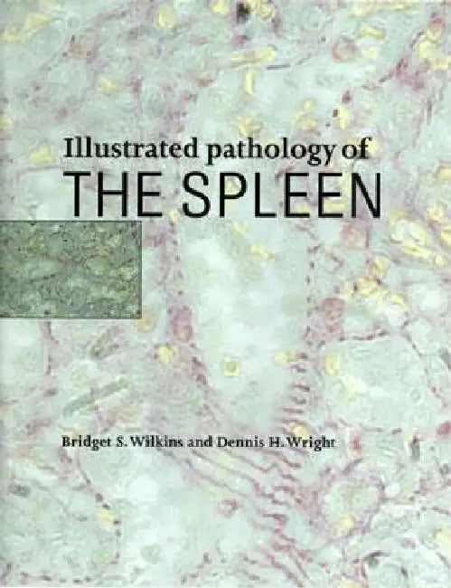 Illustrated Pathology of the Spleen (English, Bridget S. Wilkins | Dennis H. Wright)