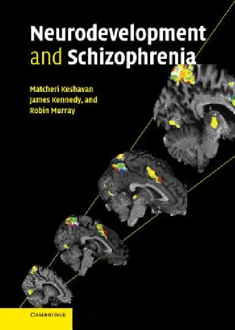 Neurodevelopment and Schizophrenia (English, Robin Murray | Matcheri Keshavan | James Kennedy)