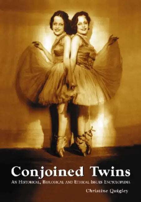 Conjoined Twins (English, Christine Quigley)