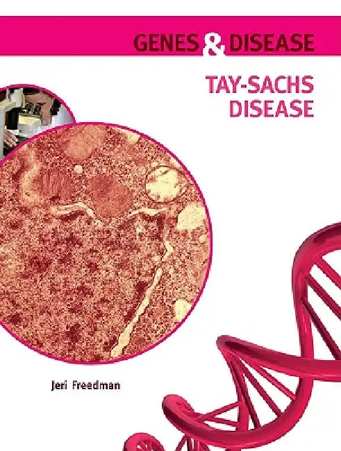 Tay-Sachs Disease (English, Jeri Freedman)