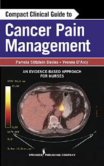 Compact Clinical Guide to Cancer Pain Management (English, Pamela Davies | Yvonne D'Arcy | Yvonne D'Arcy)