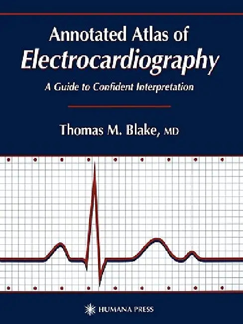 Annotated Atlas of Electrocardiography (English, Thomas M. Blake)
