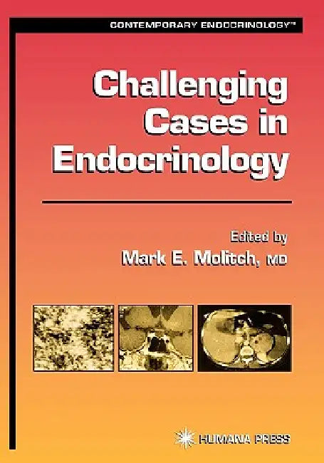 Challenging Cases in Endocrinology (English, Mark E. Molitch)