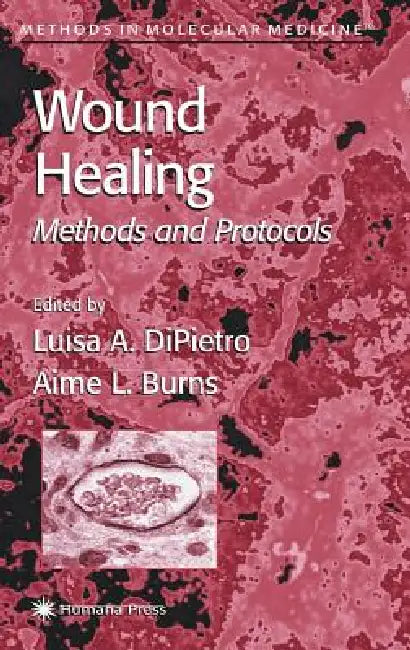 Wound Healing (English, Luisa A. DiPietro | Aime L. Burns)