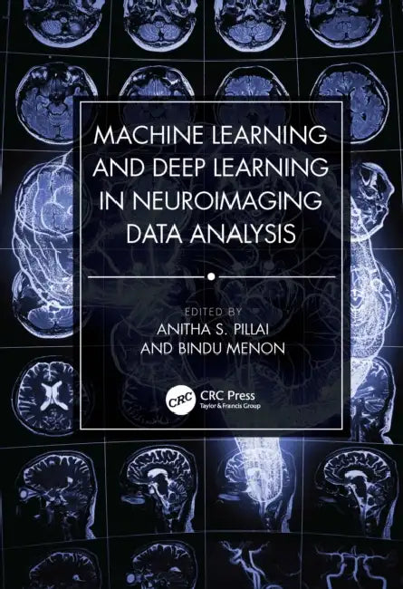 Machine Learning and Deep Learning in Neuroimaging Data Analysis (English, Anitha S. Pillai | Bindu Menon)