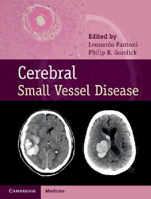 Cerebral Small Vessel Disease (English, Leonardo Pantoni | Philip B. Gorelick)