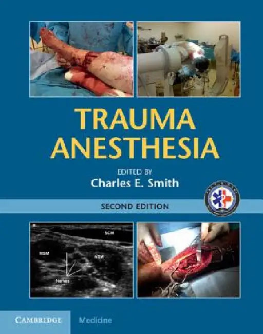 Trauma Anesthesia (English, Charles E. Smith)