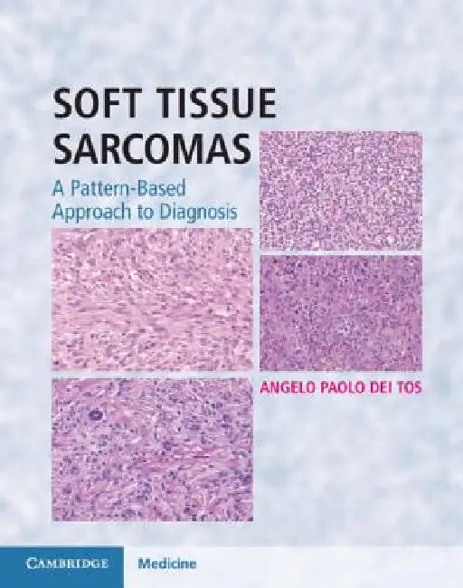 Soft Tissue Sarcomas Hardback with Online Resource (English, Angelo Paolo Dei Tos)
