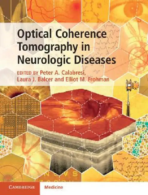 Optical Coherence Tomography in Neurologic Diseases (English, Peter A. Calabresi | Laura J. Balcer | Elliot M. Frohman)