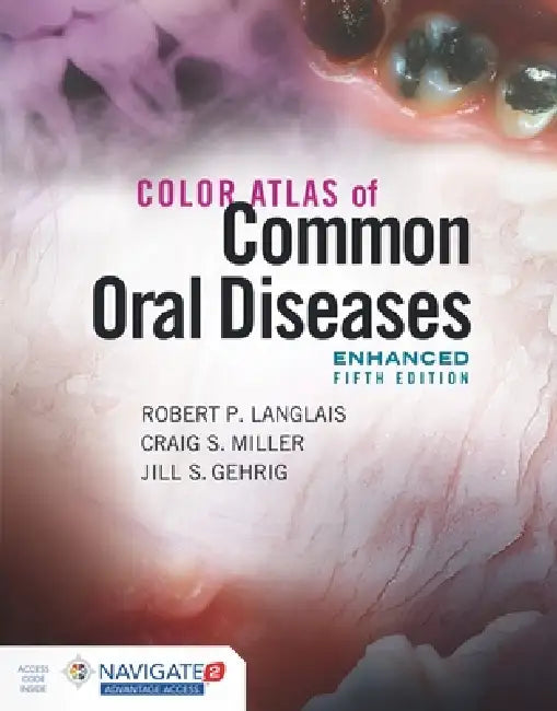 Color Atlas of Common Oral Diseases, Enhanced Edition (English, Robert P. Langlais | Craig S. Miller | Jill S. Gehrig)