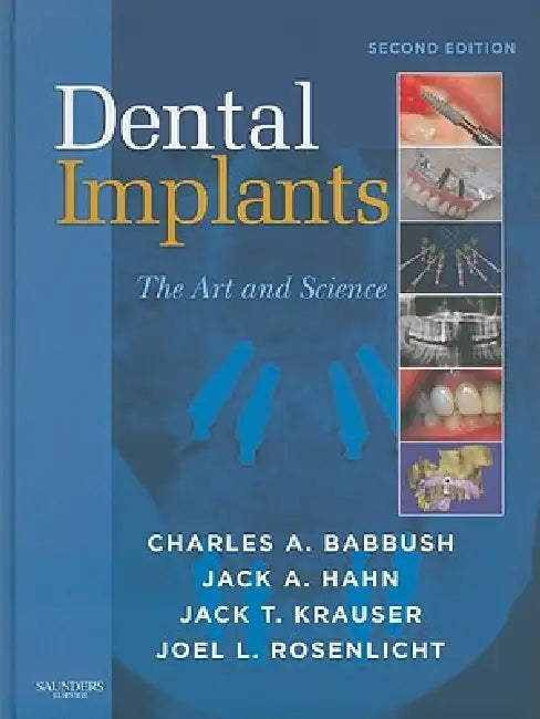 Dental Implants (English, Charles A. Babbush | Jack A. Hahn | Jack T. Krauser)