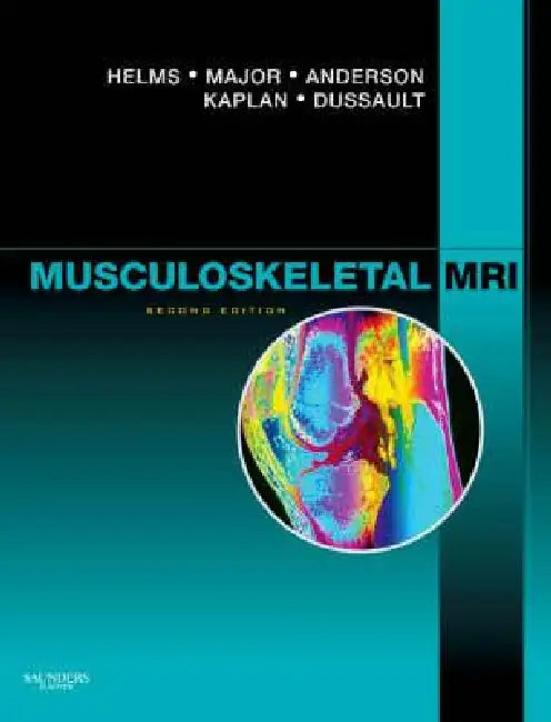 Musculoskeletal MRI (English, Clyde A. Helms | Nancy M. Major | Mark W. Anderson)