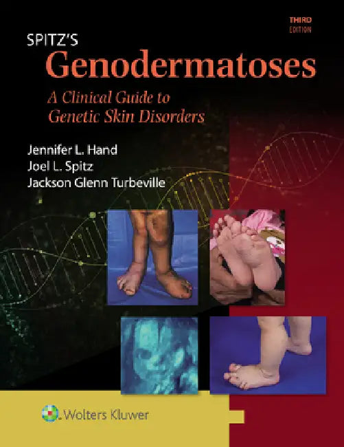 Spitz's Genodermatoses (English, Joel L. Spitz | Jennifer Lynn Hand | Jackson Glenn Turbeville)