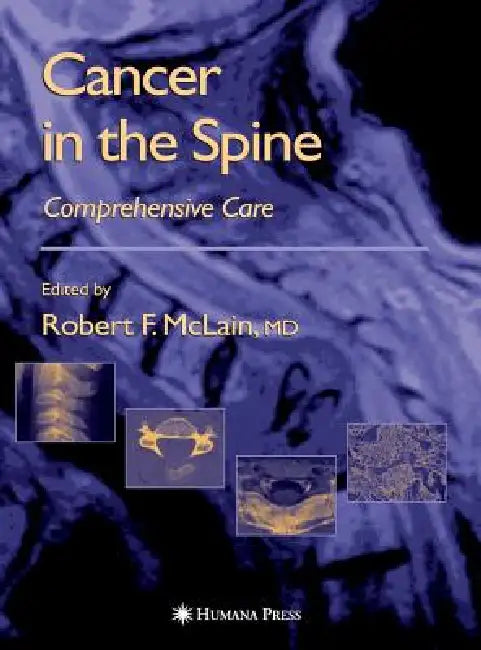 Cancer in the Spine (English, Robert F. McLain | Maurie Markman | Ronald M. Bukowski)