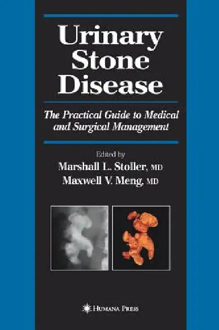 Urinary Stone Disease (English, Marshall L. Stoller | Maxwell V. Meng)