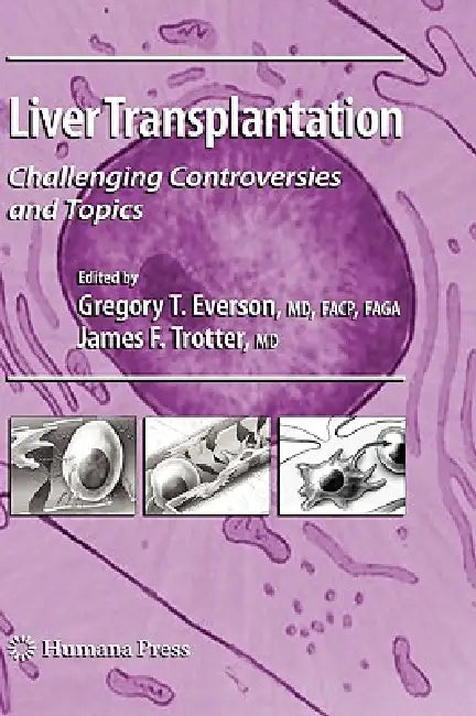 Liver Transplantation (English, Gregory T. Everson | James F. Trotter)