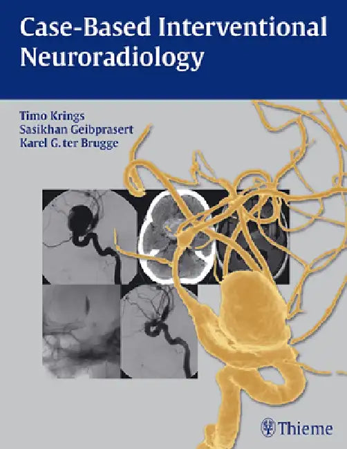 Case-Based Interventional Neuroradiology [With Access Code] (English, Timo Krings | Sasikhan Geibprasert | Karel Ter Brugge)